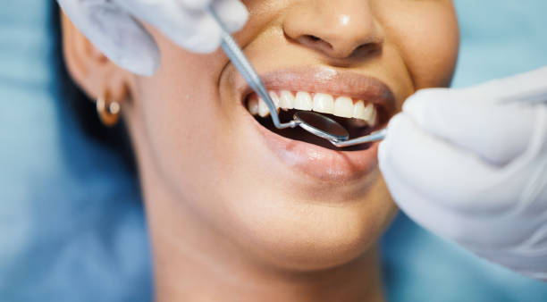 Best Emergency Tooth Extraction in Eufaula, AL