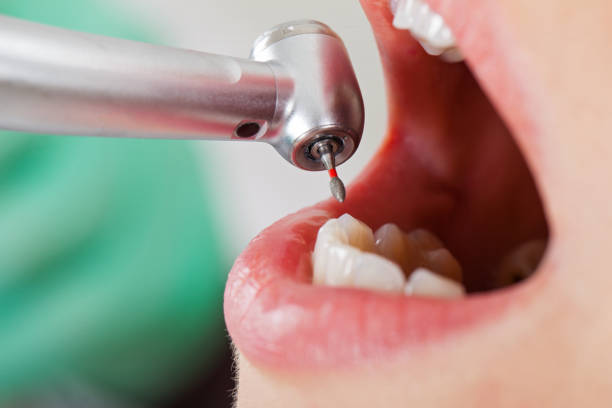 Professional Emergency Dentist in AL